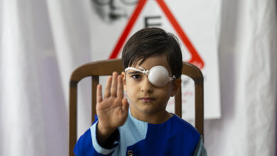 میانگین شیوع تنبلی چشم در ایران به مراتب کمتر از دنیاست