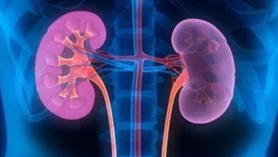 الکل با سنگ کلیه رفتار می کند؟