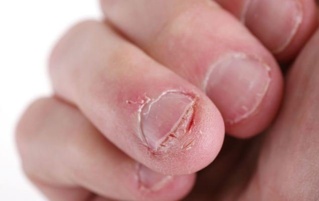 آیا اشعه ماوراء بنفش برای پوست و ناخن ها مضر است؟
