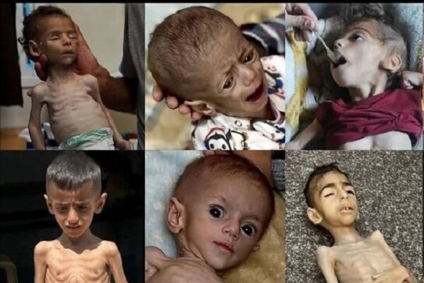 غزه در زیر آتش و گرسنگی ؛ صف های غذایی محراب می شوند