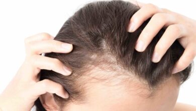 غذاهایی که می توانند باعث ریزش مو شوند