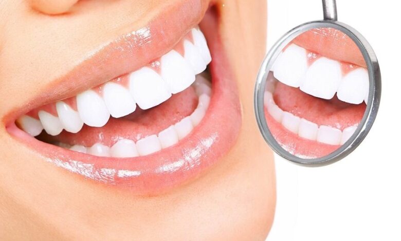 غذاهای مفید برای سلامت دندان