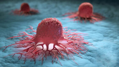 انجام غربالگری ۳ سرطان مهم در کشور به صورت آزمایشی