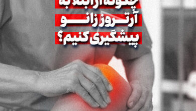 چگونه می توان از آرتریت زانو جلوگیری کرد؟