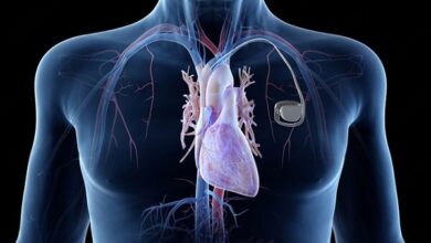 رسوبات پنهان پیری قلب را تسریع می کنند - آژانس خبری مهر | اخبار ایرانی و جهانی