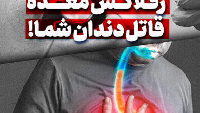 معده قاتل دندان خود را ریفلاکس کنید!