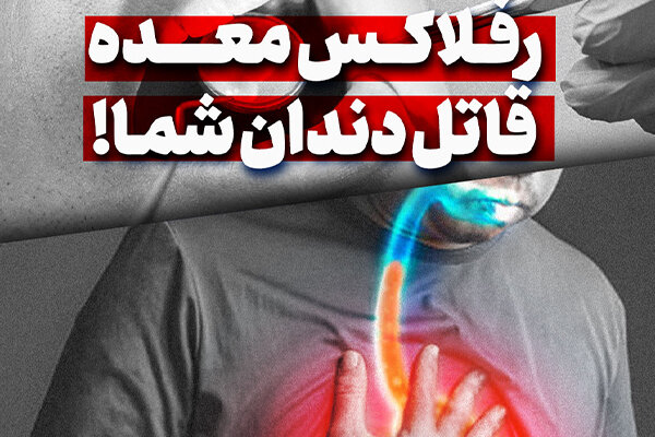 معده قاتل دندان خود را ریفلاکس کنید!