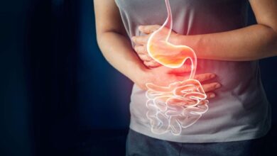 اسلاید معده مراقبت بعد از عمل چیست؟