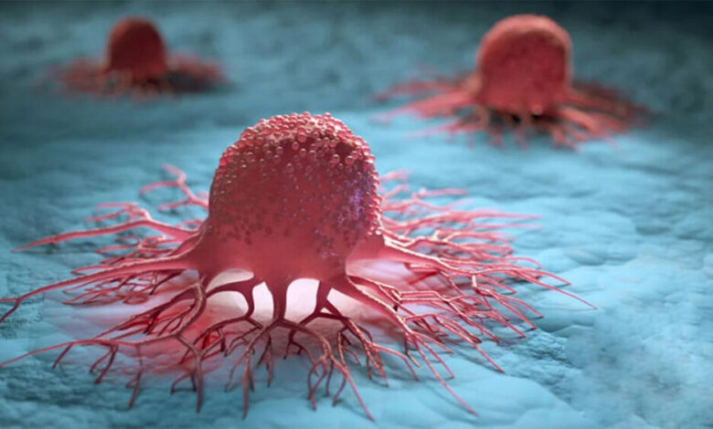 بی‌توجهی به سلیاک و احتمال ابتلا به سرطان روده