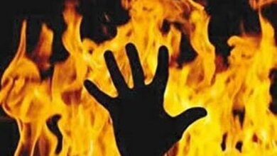 نمایشگاه عکس سوختگی و داستانهای سوختگی - آژانس خبری مهر | اخبار ایرانی و جهانی