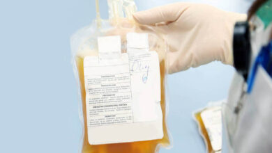 درمان مبتلایان به بیماری هاری با جمع آوری پلاسما