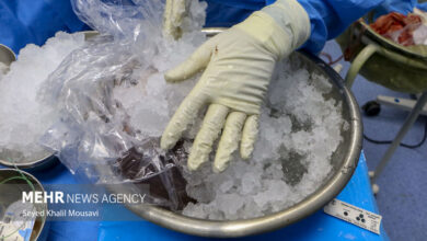 مرکز اصلی پیوند کبد ایران کجاست؟ - آژانس خبری مهر ایرانی و اخبار جهانی