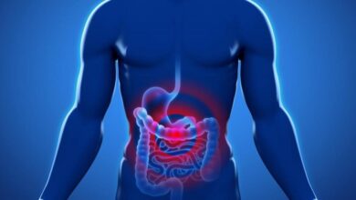 کدام غذاها خطر ابتلا به سرطان روده بزرگ را افزایش می دهند؟