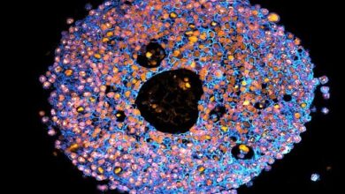 گامی نو در پزشکی: چاپ سه‌بعدی جفت‌های کوچک جنینی برای بررسی بهتر مشکلات بارداری