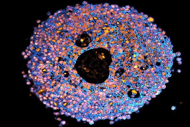 گامی نو در پزشکی: چاپ سه‌بعدی جفت‌های کوچک جنینی برای بررسی بهتر مشکلات بارداری