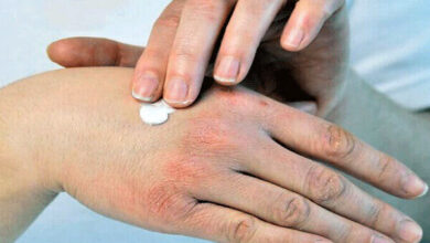 استراتژی های ساده برای جلوگیری از خشکی پوست در پاییز