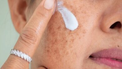 با منافذ باز چه کاری باید انجام شود؟/ آیا این منافذ قطعاً درمان می شوند؟