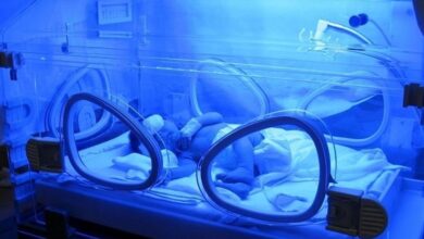 باورهای نادرست تغذیهای درباره زردی نوزادان