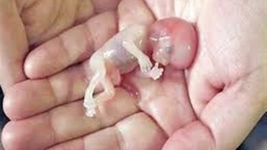 سقط جنین تنها در چارچوب قانون و با احراز شرایط مشخص مجاز است