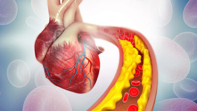 طلای مایع به کلسترول پایین
