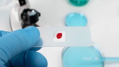 عوامل شیردهی برای کاهش سرطان سینه - آژانس خبری مهر | اخبار ایرانی و جهانی