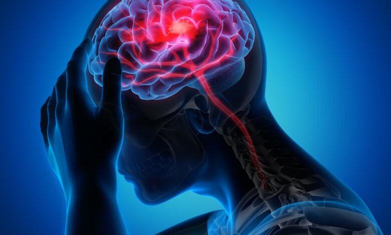 ایرانیان 5 سال تحت سن متوسط ​​جهان سکته می کنند