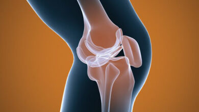 درد مفصل ران هنگام راه رفتن چیست - آژانس خبری مهر | اخبار ایرانی و جهانی