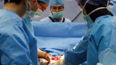 باورهای نادرست درباره مرگ مغزی؛ مانعی بزرگ بر سر اهدای عضو