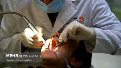 پیشرفت دندانپزشکی با نوآوری آسفالت می شود - آژانس خبری مهر | اخبار ایرانی و جهانی