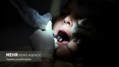 وضعیت خدمات دندانپزشکی نگران کننده است - آژانس خبری مهر | اخبار ایرانی و جهانی