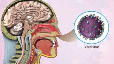 چگونه سکته مغزی از گرفتگی/ خلط بینی را درمان کنیم؟