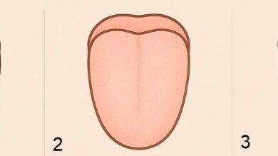 تشخیص انواع بیماری ها با بررسی زبان/ دندان روی زبان چیست؟