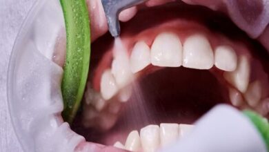 ضرورت سلامت دهان و دندان و پیشگیری از بیماری لثه - آژانس خبری مهر | اخبار ایرانی و جهانی