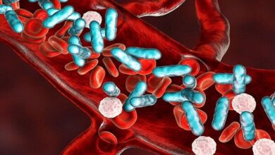 خطر ابتلا به سپسیس با دو برابر دیابت نوع 2 - آژانس خبری مهر | اخبار ایرانی و جهانی