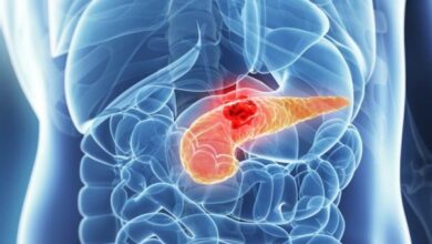 نقش میکروب های دهان در سرطان لوزالمعده - آژانس خبری مهر | اخبار ایرانی و جهانی