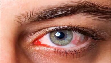 نوآوری در ترمیم قرنیه - خبرگزاری سلامت