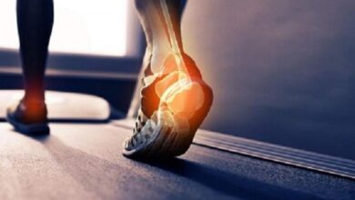 ۸۰ درصد مردم از ابتلا به پوکی استخوان بی خبرند/ مرگ و میر ۳ هزار نفر در سال