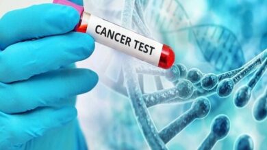 مراقبت از دهان و دندان بخش مهمی از درمان بیماران سرطانی + علائم هشدار دهنده است