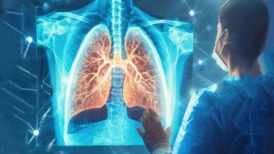 سل هنوز در کشور وجود دارد، اما کاملا قابل درمان است