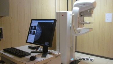پیشگیری از سرطان سینه در سمنان طرح ماموگرافی رایگان راه اندازی شد - خبرگزاری مهر ایران و جهان
