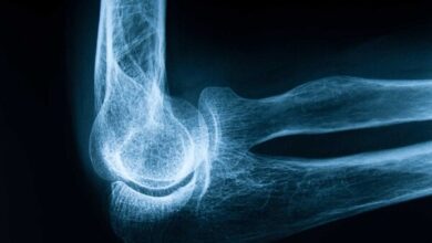 پوکی استخوان؛ نبردی خاموش در معماری بدن