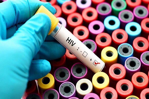 هشدار سازمان جهانی بهداشت نسبت به افزایش موارد HIV در فیلیپین - خبرگزاری مهر ایران و جهان