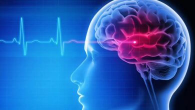 رسیدن سریع به بیمارستان کلید درمان موثر سکته مغزی است