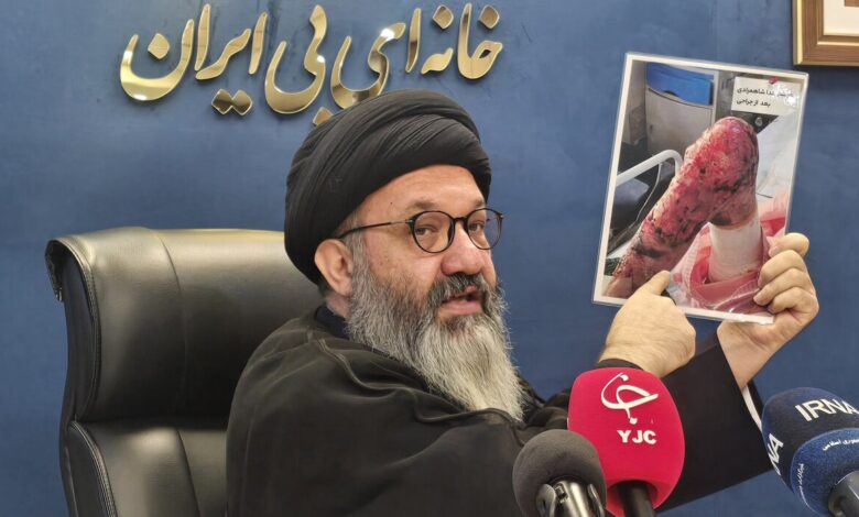 حدود 1250 بیمار «ای بی» در کشور شناسایی شدند - خبرگزاری مهر ایران و جهان