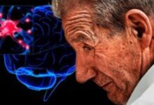 رابطه مواد شیمیایی صنعتی با بیماری پارکینسون - خبرگزاری مهر ایران و جهان