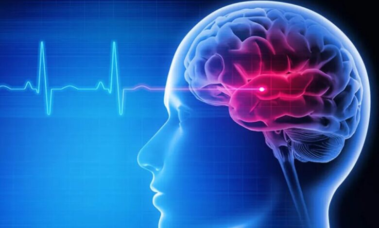 افزایش نگران‌کننده بروز سکته مغزی در سنین پایین‌تر از میانگین جهانی