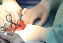 مهاجرت پزشکان؛ بیماری مزمن سیستم درمانی یا عارضه قابل درمان؟