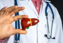 پیشگیری و غربالگری هپاتیت کلید حفظ سلامت کبد است - خبرگزاری مهر ایران و جهان