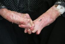 ضرورت اطلاع رسانی ازدواج های خانوادگی و بیماری های ژنتیکی - خبرگزاری مهر ایران و جهان