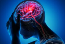 سکته مغزی دومین عامل مرگ و میر در ایران - خبرگزاری مهر ایران و جهان